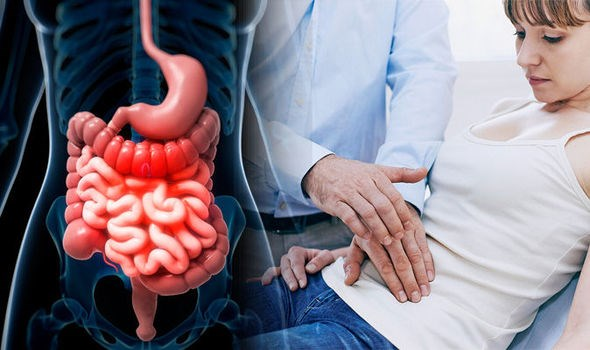 Hội chứng ruột kích thích (IBS) là gì?