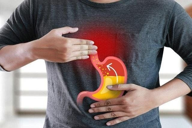 Sử dụng men vi sinh như thế nào cho người bị trào ngược dạ dày?